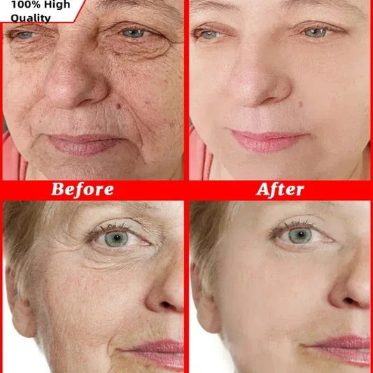 Japan Sakura Wrinkle Remover Face Serum. - Maison Novaire