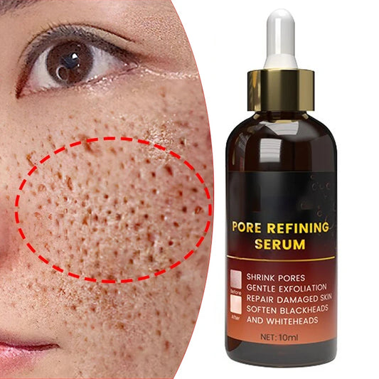 Acne Treatment Anti Aging Serum. - Maison Novaire