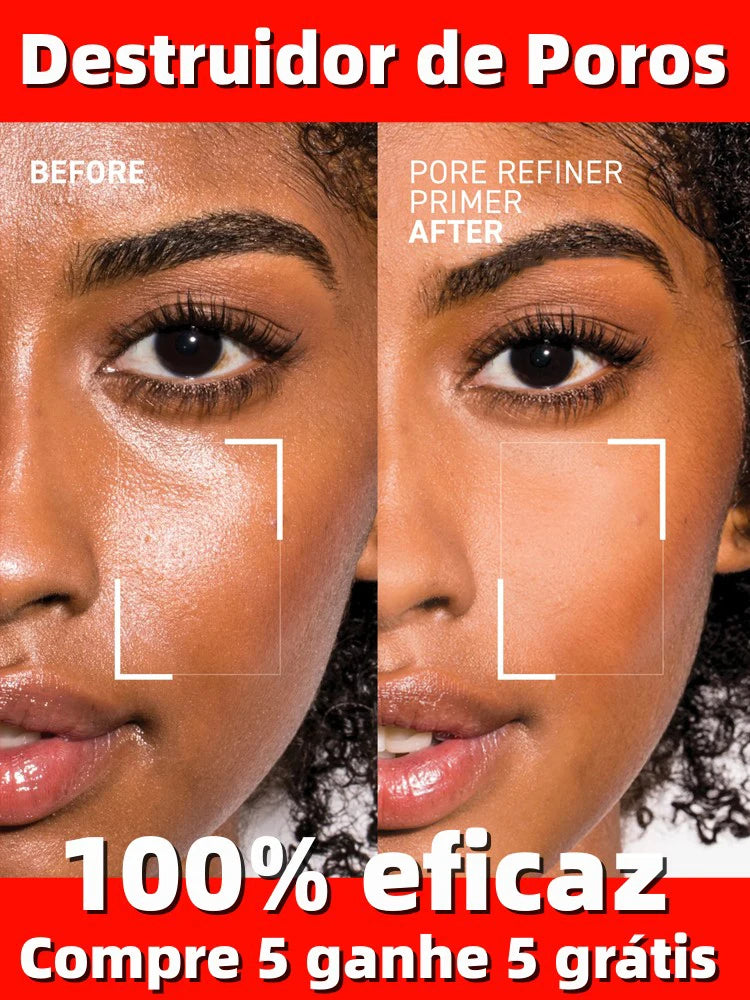Acne Treatment Anti Aging Serum. - Maison Novaire