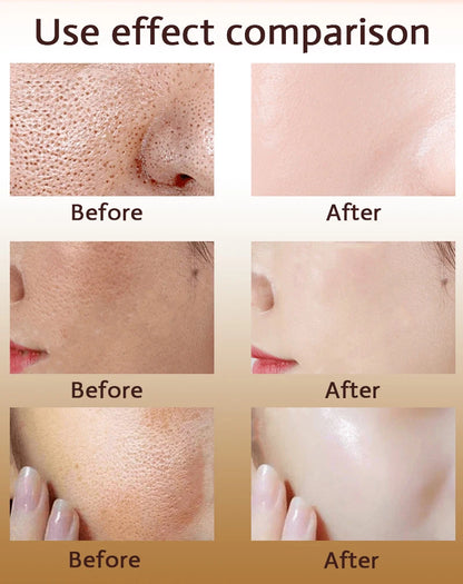Acne Treatment Anti Aging Serum. - Maison Novaire