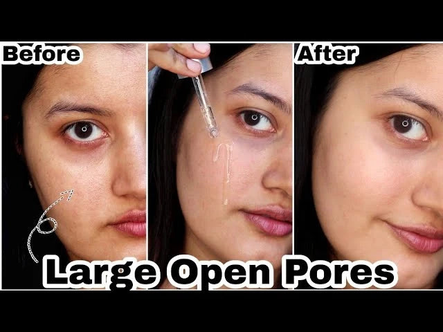 Acne Treatment Anti Aging Serum. - Maison Novaire