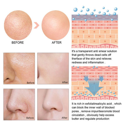 Acne Treatment Anti Aging Serum. - Maison Novaire