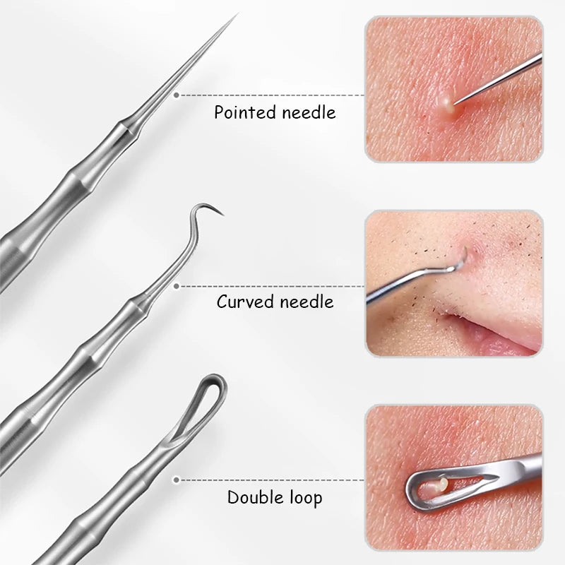 Acne and Pimples Removal Needles. - Maison Novaire