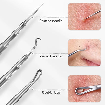 Acne and Pimples Removal Needles. - Maison Novaire