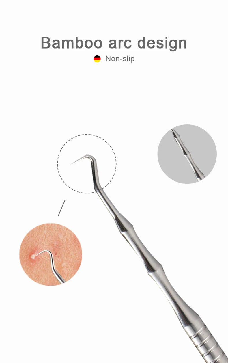Acne and Pimples Removal Needles. - Maison Novaire