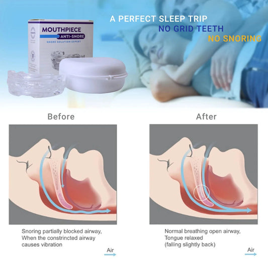 Adjustable Anti Snoring Mouth Guard. - Maison Novaire #