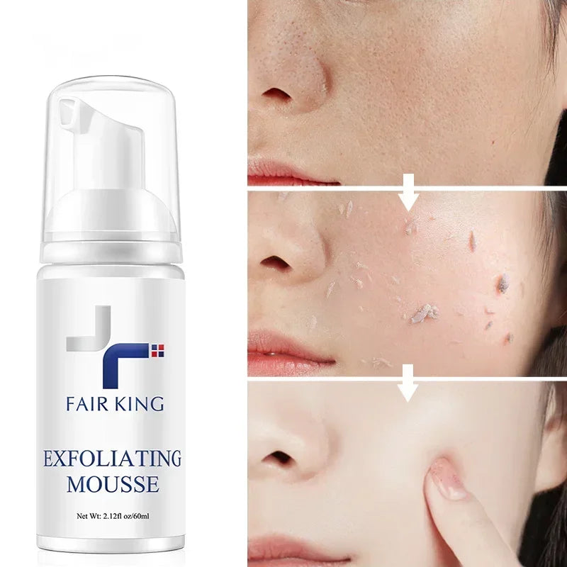 FAIR KING Exfoliating Mousse – Pore Minimizing & Oil Control Cleanser - Maison Novaire