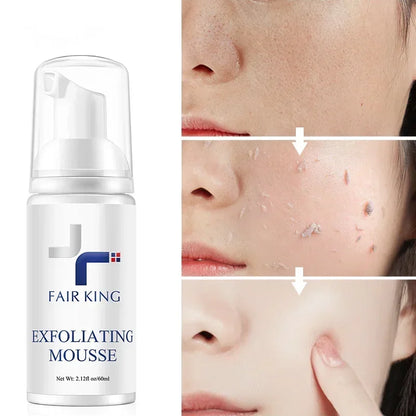 FAIR KING Exfoliating Mousse – Pore Minimizing & Oil Control Cleanser - Maison Novaire