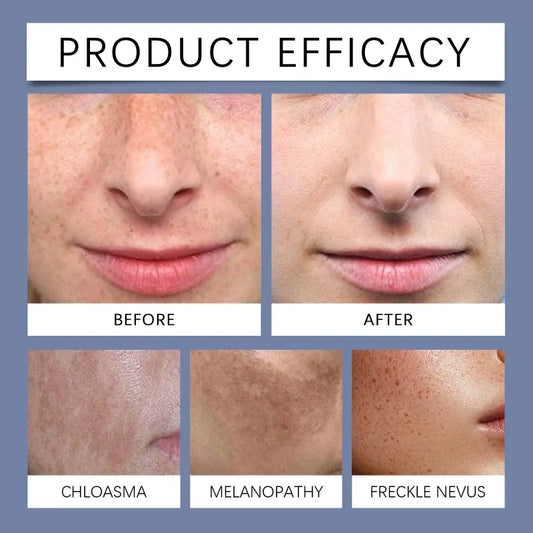 Face Dark Skin Brightening Cream. - BLAKESTORE-NG