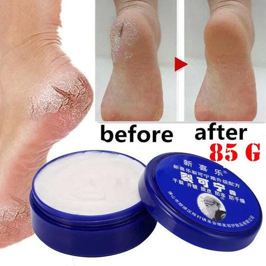 Feet and Hand Crack Removal Cream. - Maison Novaire