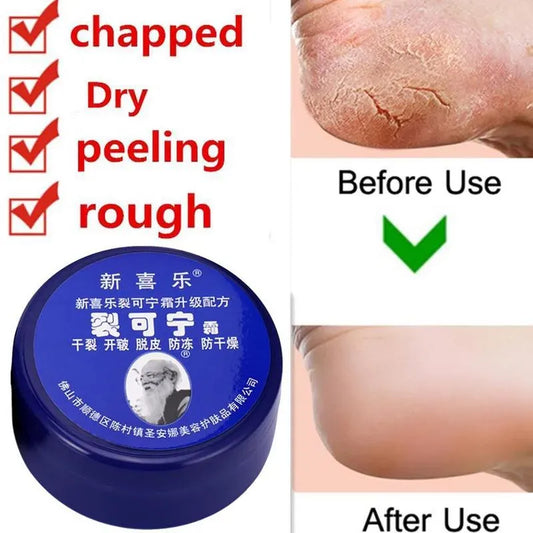 Feet and Hand Crack Removal Cream. - Maison Novaire