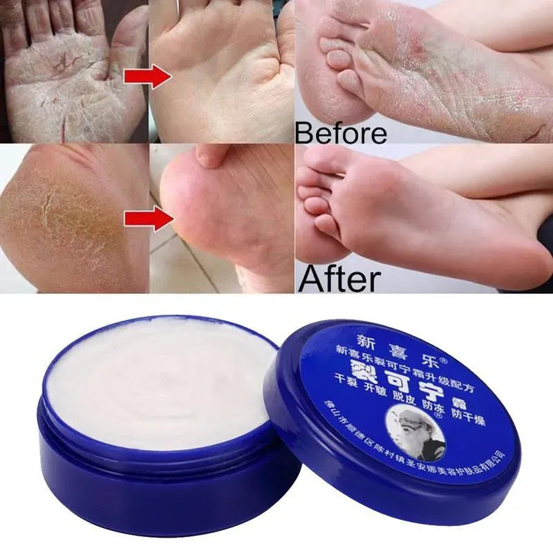 Feet and Hand Crack Removal Cream. - Maison Novaire