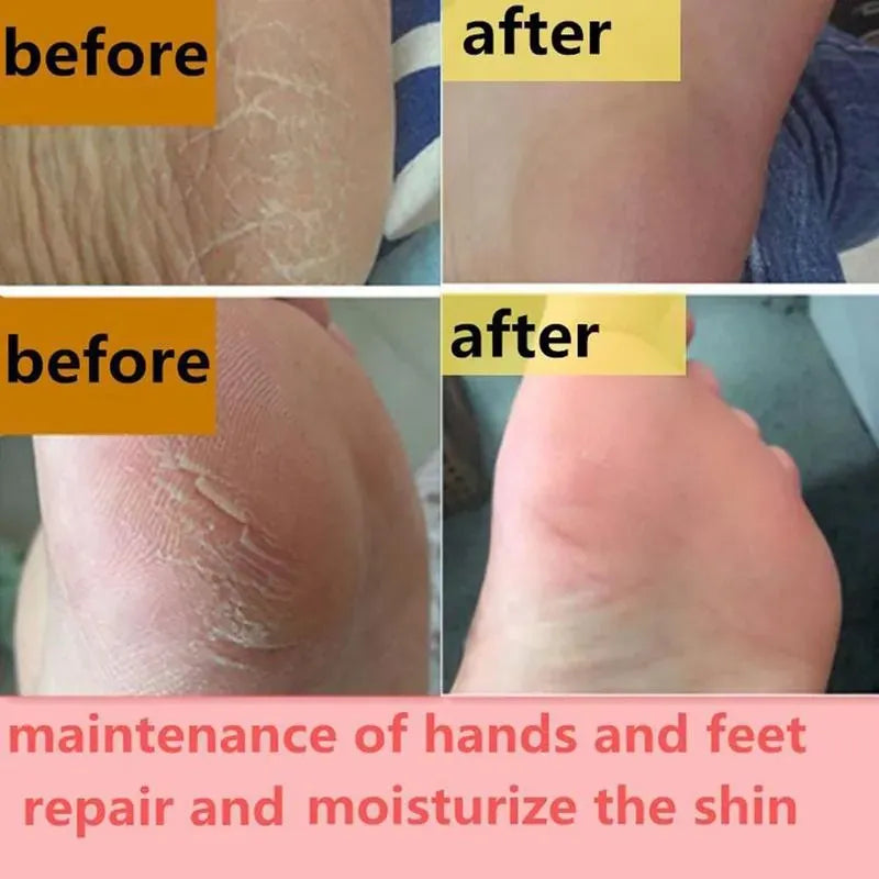 Feet and Hand Crack Removal Cream. - Maison Novaire