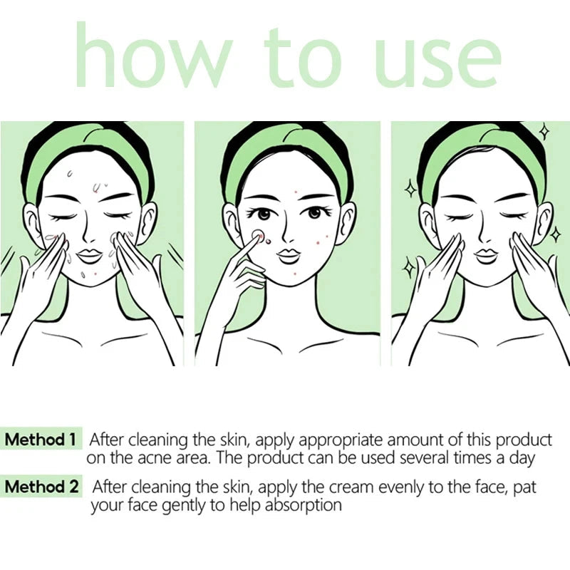 Herbal Acne Removal Face Cream. - Maison Novaire