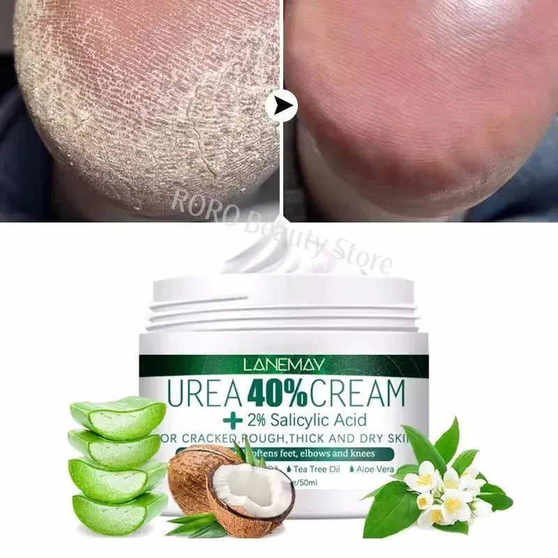 Herbal Anti Crack Foot Heel Cracking Repair Cream. - Maison Novaire