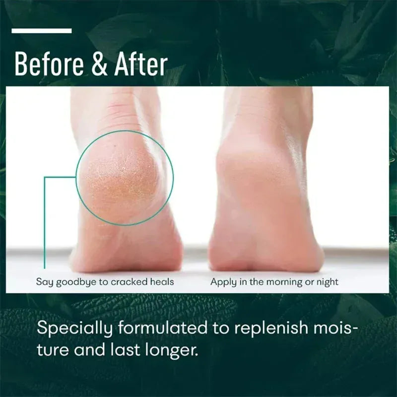 Herbal Anti Crack Foot Heel Cracking Repair Cream. - Maison Novaire