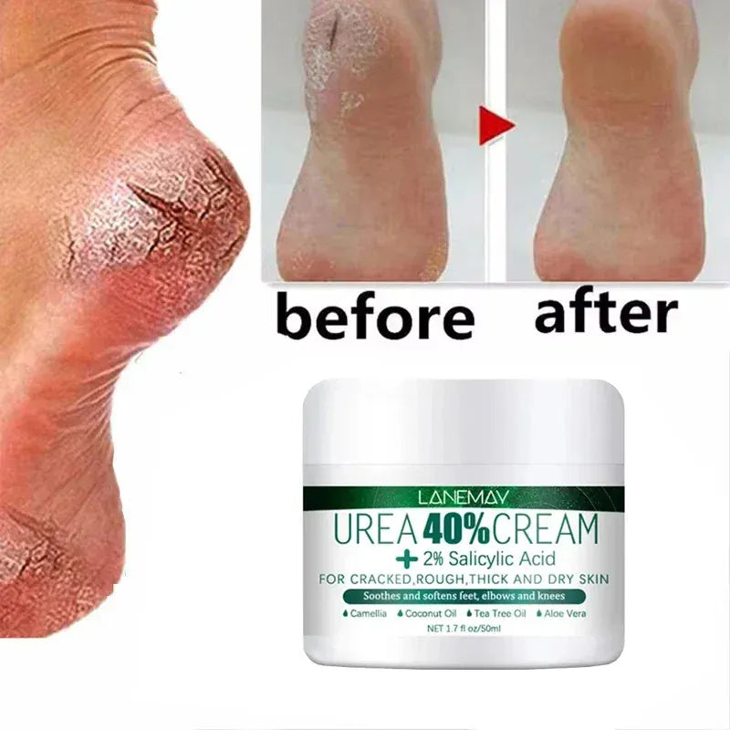 Herbal Anti Crack Foot Heel Cracking Repair Cream. - Maison Novaire