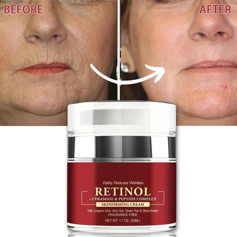 Instant Retinol Cream – Anti-Aging Firming & Lifting - Maison Novaire