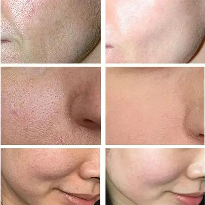 Japan Sakura Wrinkle Remover Face Serum. - Maison Novaire