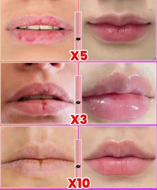 Natural Lip Plumping Serum – Volumizing, Moisturizing & Smoothing Lip Enhancer - BLAKESTORE-NG