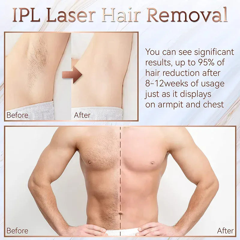 Painless Electric Epilator Laser Hair Removal. - Maison Novaire