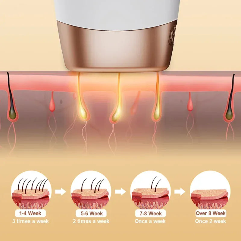 Painless Electric Epilator Laser Hair Removal. - Maison Novaire