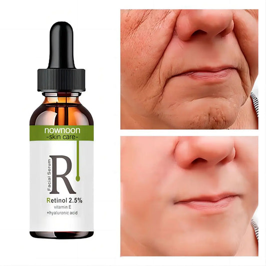 Retinol Anti Wrinkle Dark Spot Removal. - Maison Novaire