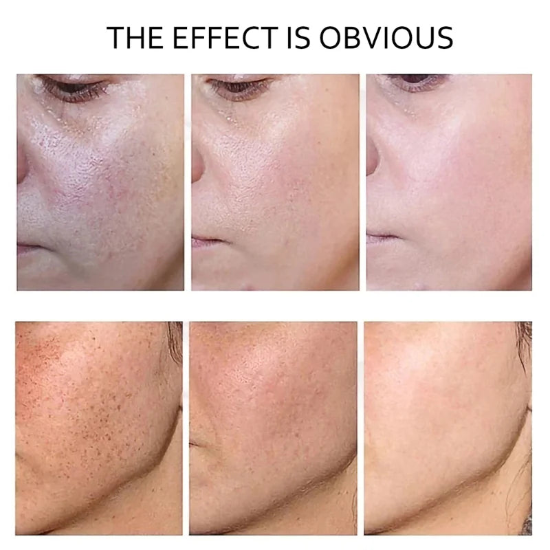 Retinol Anti Wrinkle Dark Spot Removal. - Maison Novaire