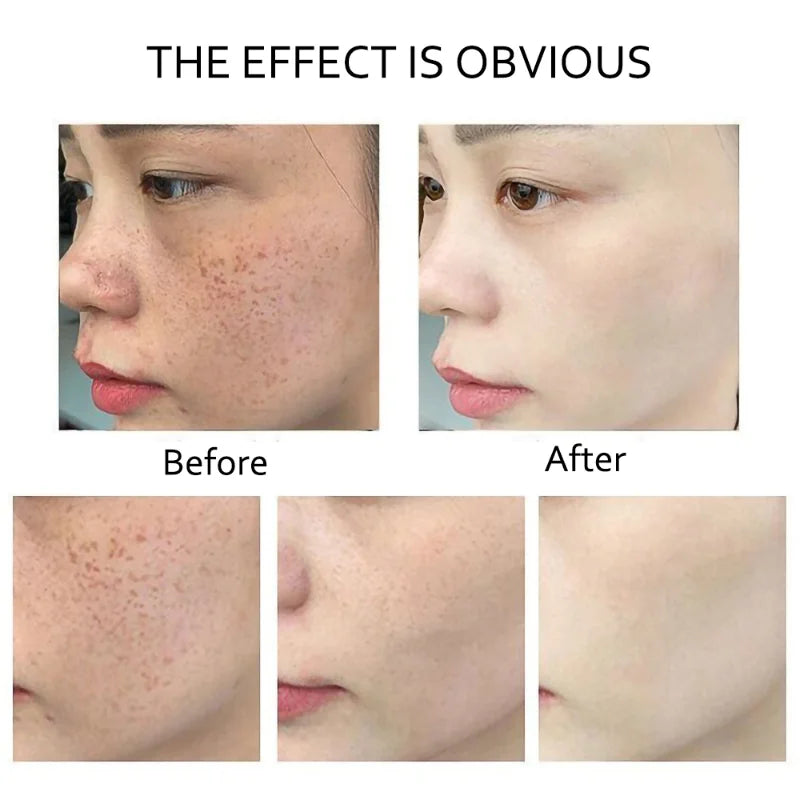 Retinol Anti Wrinkle Dark Spot Removal. - Maison Novaire
