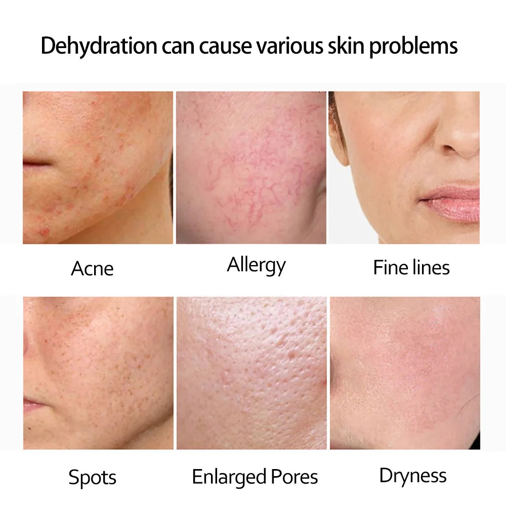 Retinol Anti Wrinkle Dark Spot Removal. - Maison Novaire