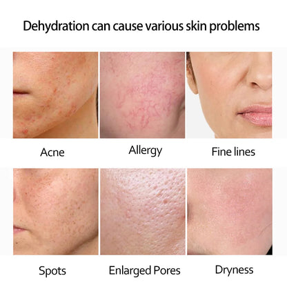Retinol Anti Wrinkle Dark Spot Removal. - Maison Novaire