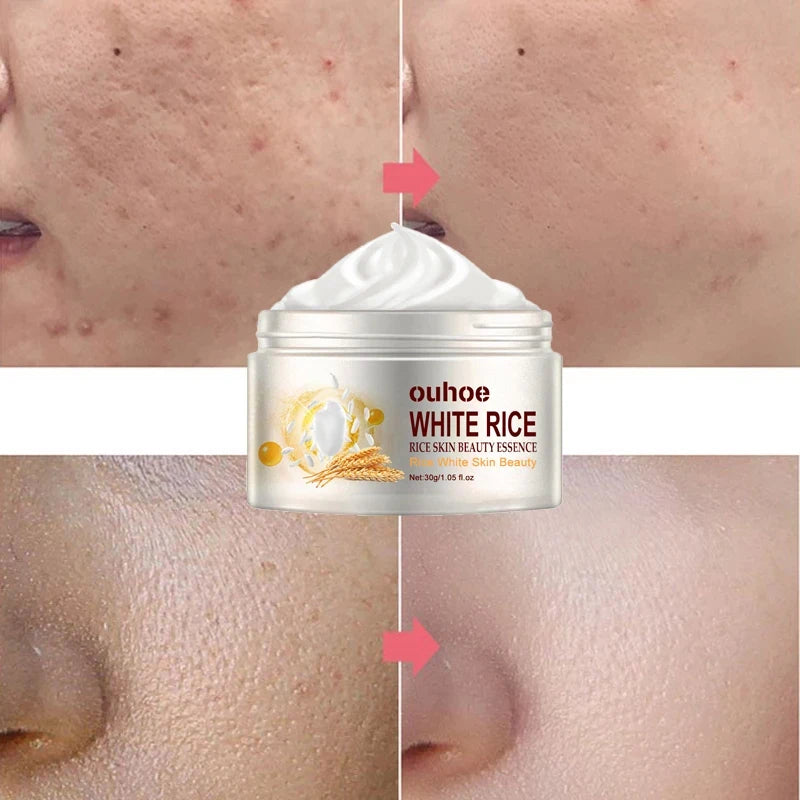 Rice Anti-Wrinkle Acne Moisturizer - BLAKESTORE-NG