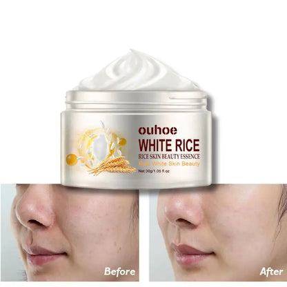 Rice Anti-Wrinkle Acne Moisturizer - BLAKESTORE-NG