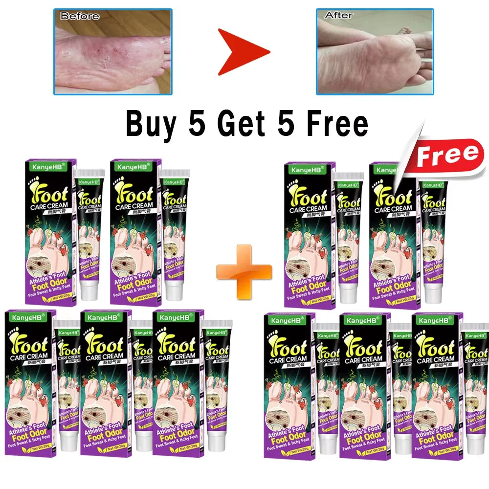 Anti-Foot Fungus Cream - BLAKESTORE-NG