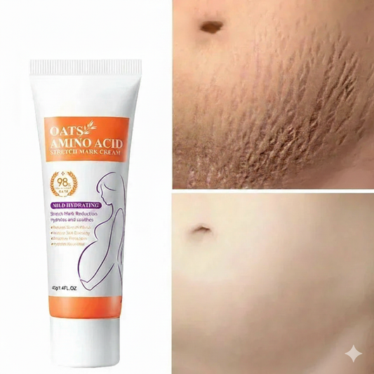 Stretch Marks Permanent Removal Cream – Belly & Body Repair - BLAKESTORE-NG