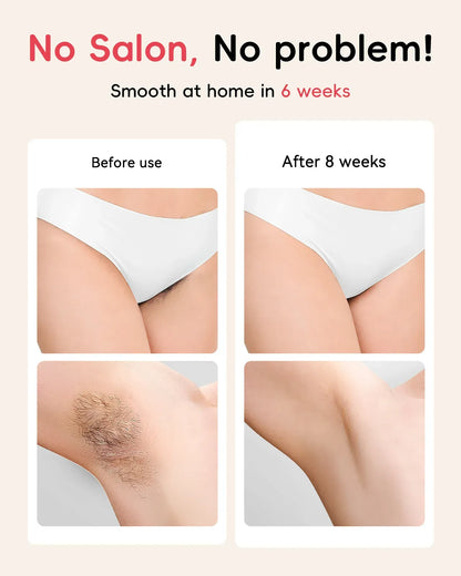 Unisex Painless Epilator Face and Armpit Hair Treatment. - BLAKESTORE-NG